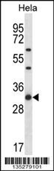 RPL7 Antibody (N-term)