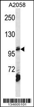 AP2B1 Antibody (Center)
