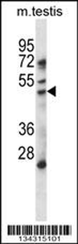 HDAC11 Antibody (Center)