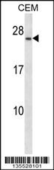 CD79A Antibody (Center)