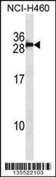 S100B/S-100 Antibody (Center)