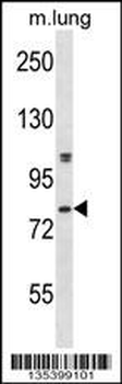 Mouse Dyrk4 Antibody (C-term)