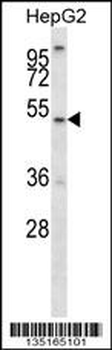 ALG11 Antibody (C-term)