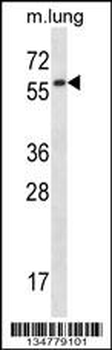 Mouse Fyn Antibody (C-term)