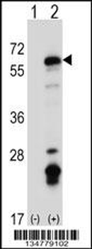 Mouse Fyn Antibody (C-term)
