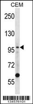 LIG1 Antibody (N-term)