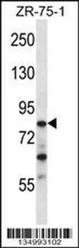 CNOT3 Antibody (N-term)