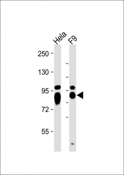 ALPL antibody