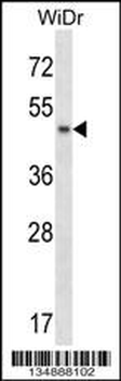 ANKS4B Antibody (Center)