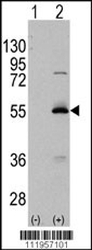 ALDH6A1 Antibody (C-term)