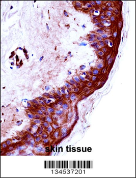 KLK9 Antibody (Center)