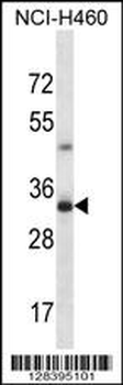 TBC1D21 Antibody (N-term)