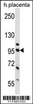 NCL Antibody (Center P291)