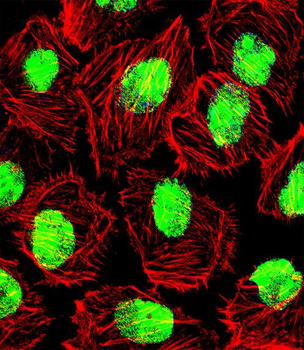 NCL Antibody (Center P291)