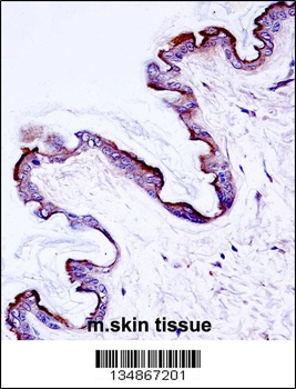 Mouse Prkch Antibody (Center)