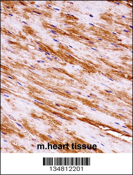 Mouse Map3k1 Antibody (C-term)