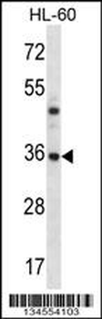 PSMB8 Antibody (N-term)
