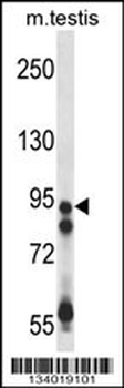 USP20 Antibody (Center)