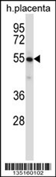 Mouse Yes1 Antibody (N-term)