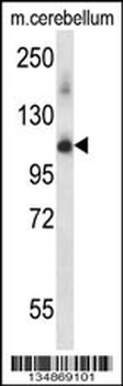 Mouse Prpf4b Antibody (N-term)