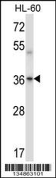 Mouse Prkaca/Prkacb Antibody (C-term)