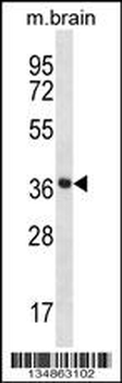 Mouse Prkaca/Prkacb Antibody (C-term)