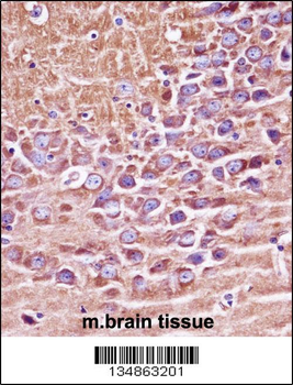Mouse Prkaca/Prkacb Antibody (C-term)