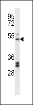 PTGIR Antibody (Center)