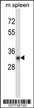 TATDN1 Antibody (Center)