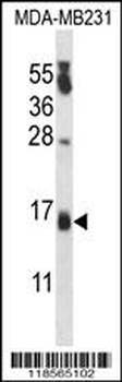 PIPPIN Antibody (Center)