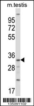 Mouse Sgk494 Antibody (Center)