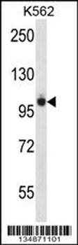 Mouse Ptk2b Antibody (Center)