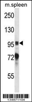 Mouse Ptk2b Antibody (Center)