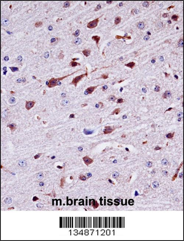 Mouse Ptk2b Antibody (Center)