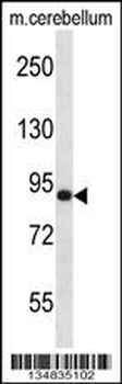 Mouse Mark3 Antibody (C-term)