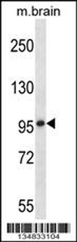 Mouse Mark1 Antibody (C-term)