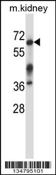 Mouse Irak3 Antibody (C-term)