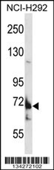 TMC8 Antibody (N-term)