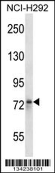 STRN Antibody (N-term)