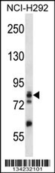 ADD3 Antibody (C-term)