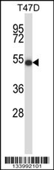 ZDH16 Antibody (C-term)