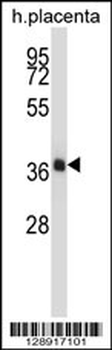 NKX2-4 Antibody (N-term)