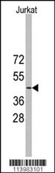 YBX2 Antibody (Center)