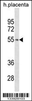 TARBP2 Antibody (N-term)