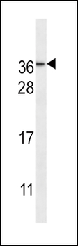 NMNAT3 Antibody (Center)