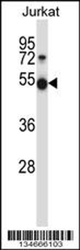 Mouse Pim1 Antibody (C-term)