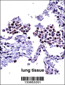 TLR8 Antibody (Center)