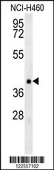 TRAF1 Antibody (N-term)