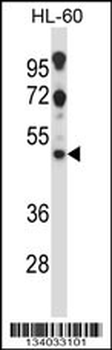HTR2C Antibody (Center)