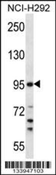 TMPRSS7 Antibody (N-term)